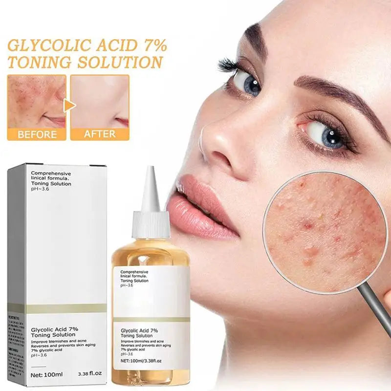 Glycolic Acid 7% Face Toner Alvionz.de
